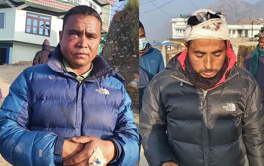 प्रचण्ड-नेपाल समूहले गर्यो कांग्रेस कार्यकर्तामाथि चक्कु प्रहार