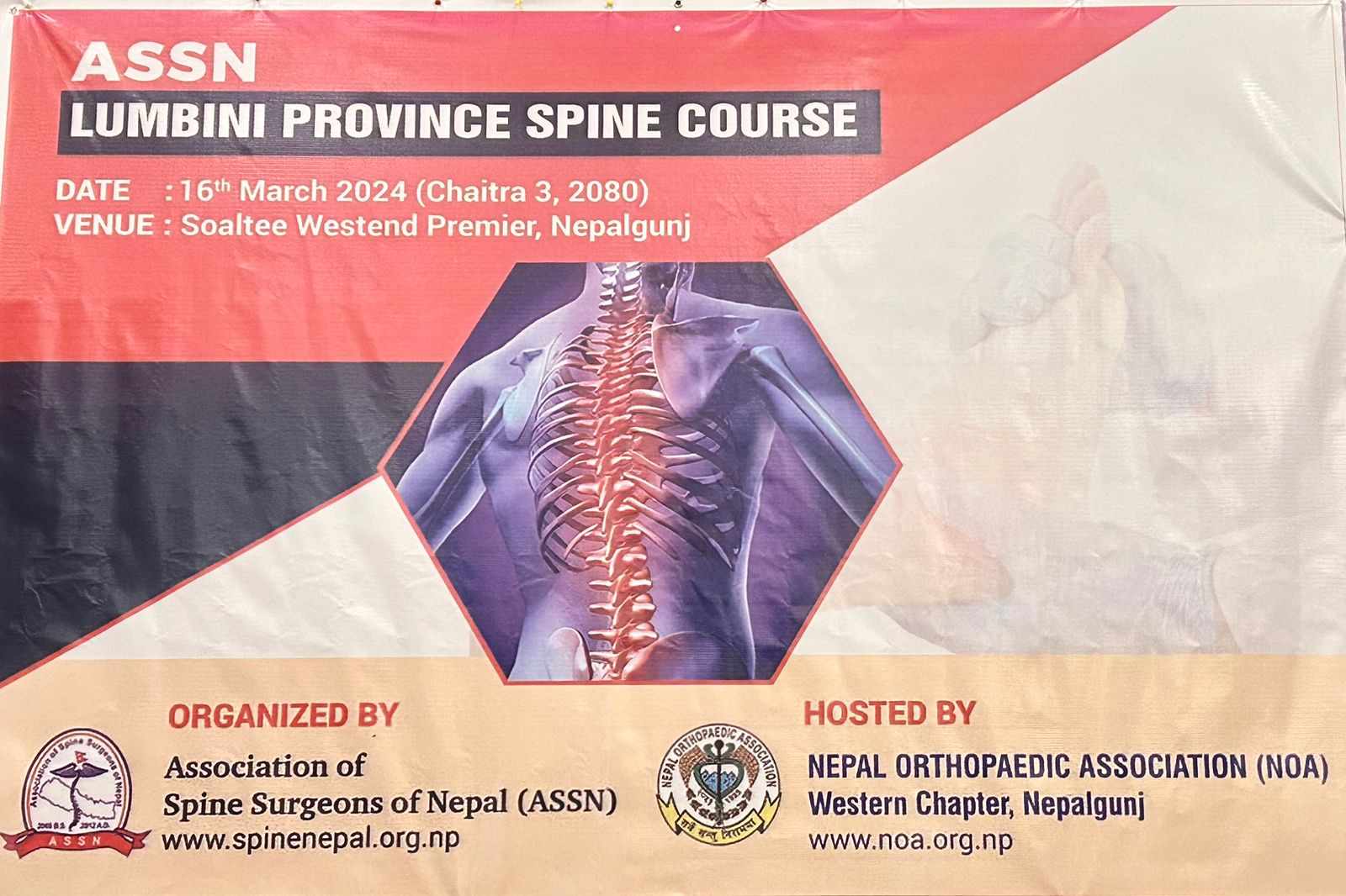 नेपालगन्जमा भोलि मेरुदण्ड सम्बन्धि कार्यशाला हुँदै