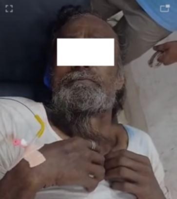 फरार प्रतिवादी पक्राउ गर्दा अवरोध भएपछि गोली चल्यो, एक जना घाइते