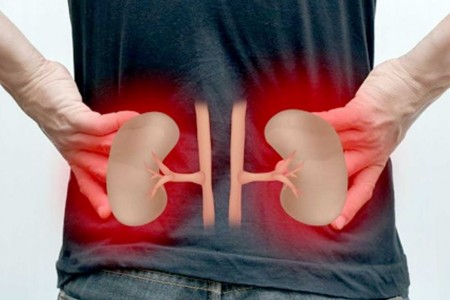 पत्रकारहरुका लागि नेपालगञ्जमा निःशुल्क मिर्गौला परीक्षण 