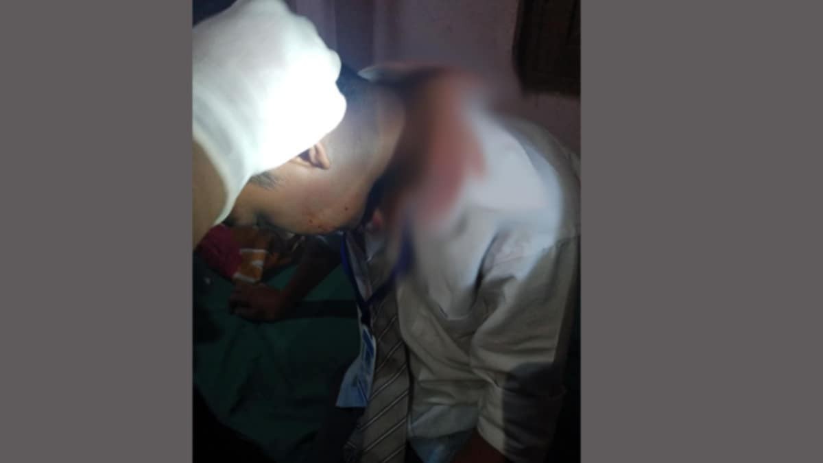शिक्षकले हानेको फलामको स्केलले लागेर विद्यार्थी घाइते